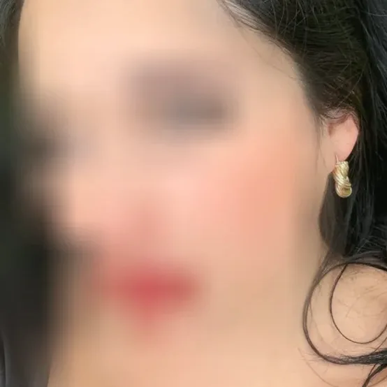 Rieke, 37